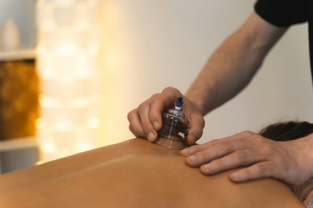 Cupping therapy is being performed on someone's back